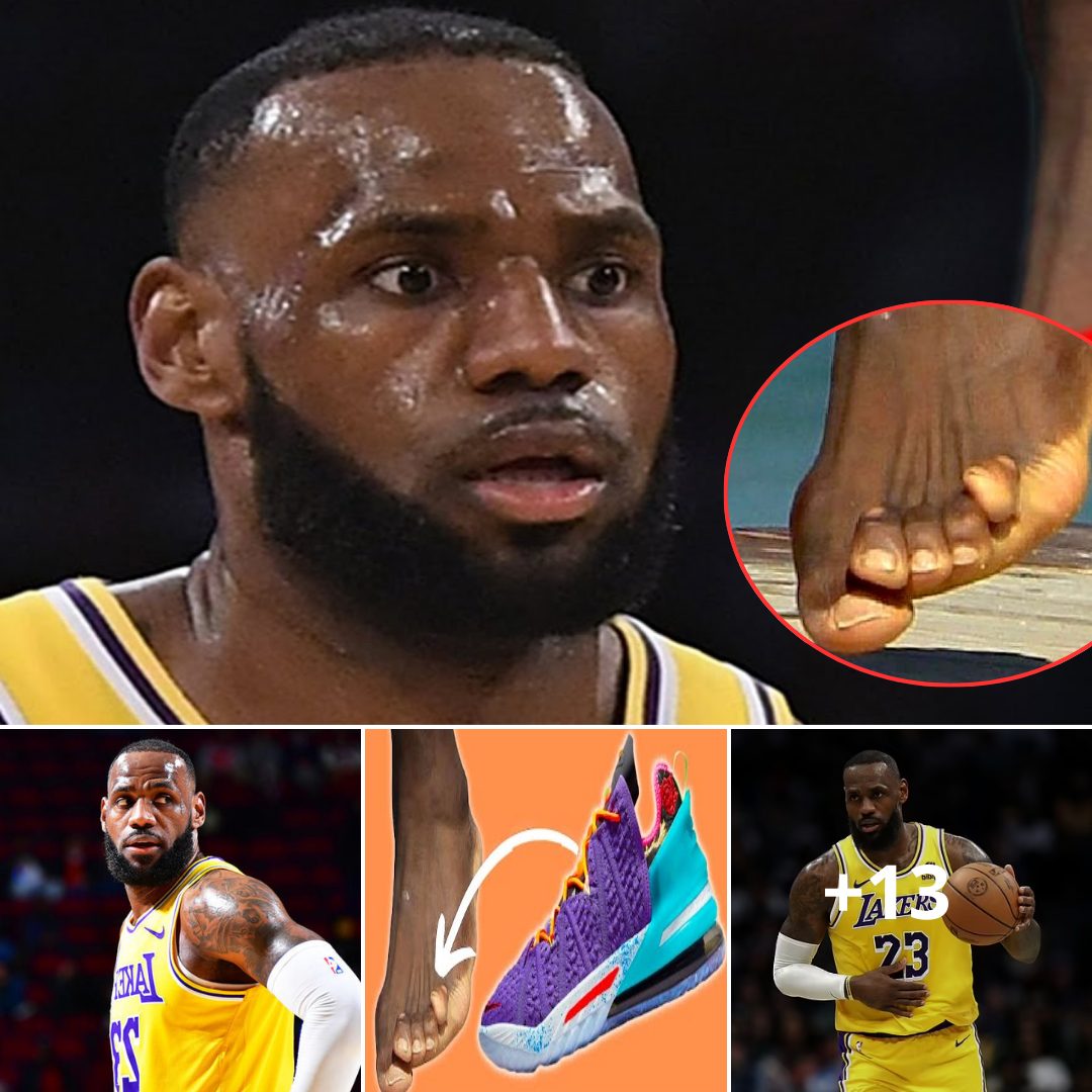 “Strange feet”:LeBron James goes viral for his FEET. - News